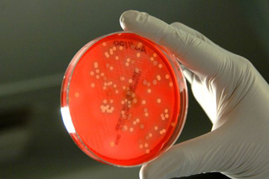 Bakteri Kolonileri